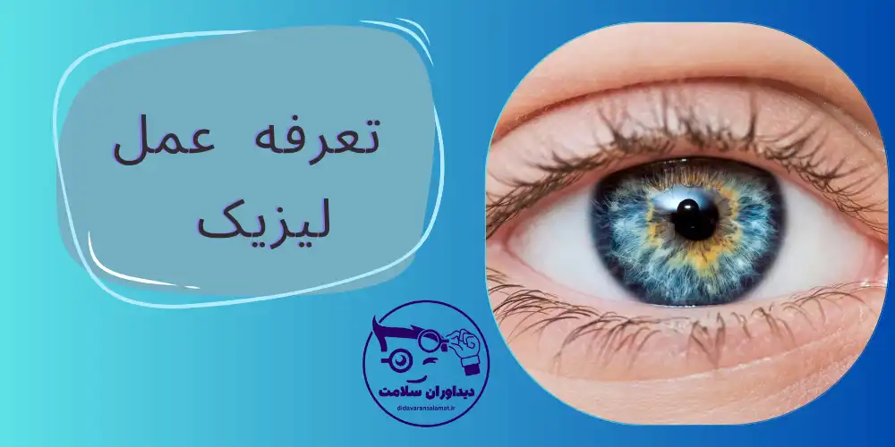 قیمت عمل لیزیک