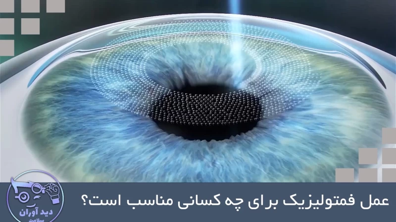 عمل فمتولیزیک برای چه کسانی مناسب است؟