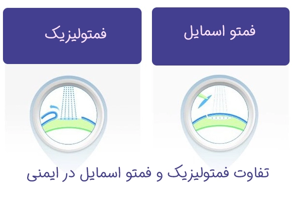 تفاوت فمتولیزیک با فمتو اسمایل